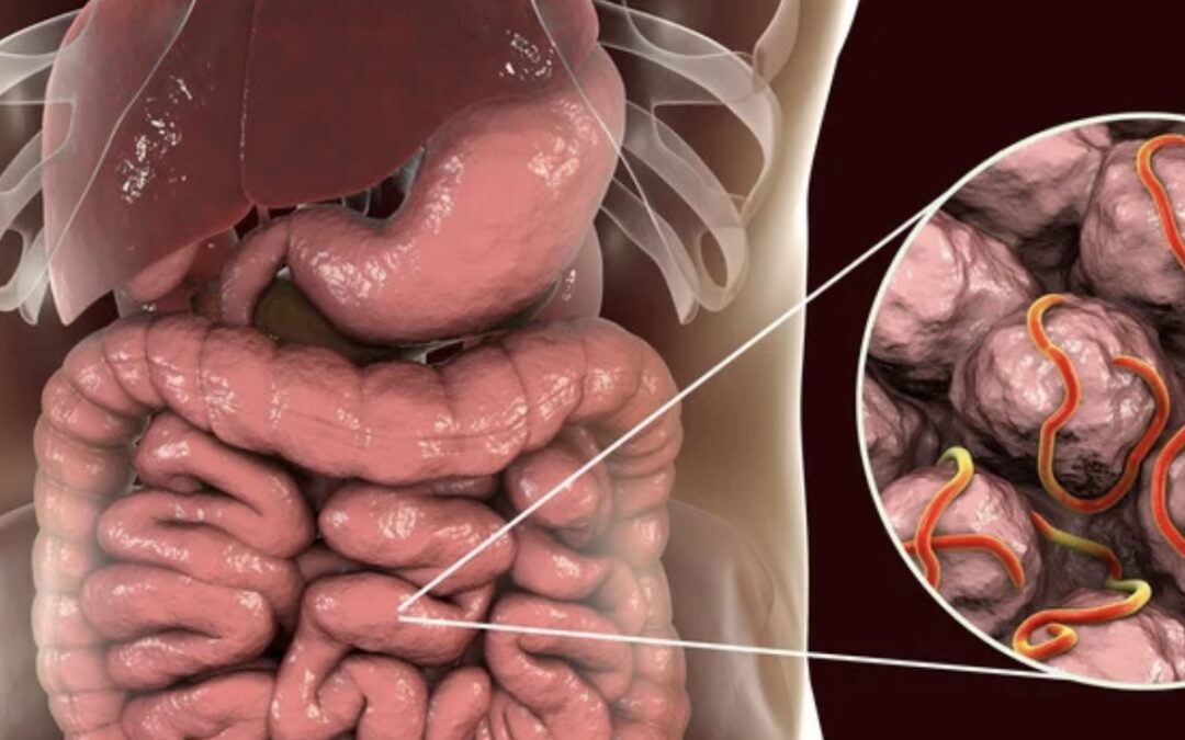 Parasites intestinaux : Une cause fréquente de perturbations physiques