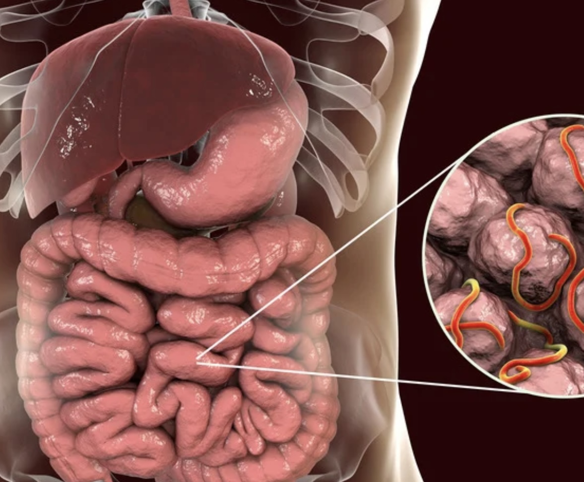 Parasites intestinaux : Une cause fréquente de perturbations physiques